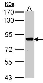 Polyclonal Rabbit anti-Human VPS16 Antibody (aa715-804, IHC, WB)