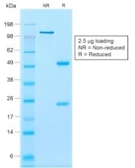 CNN1 / Calponin Antibody (clone rCNN1/832, Azide-free, Carrier-free)