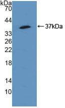 SQSTM1 Antibody (aa136-400, APC)