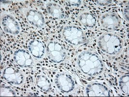 Monoclonal Mouse anti-Human GAD1 / GAD67 Antibody (clone OTI3G9, IHC, WB)