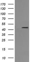 MAP2K1 / MKK1 / MEK1 Antibody (clone OTI7F3)