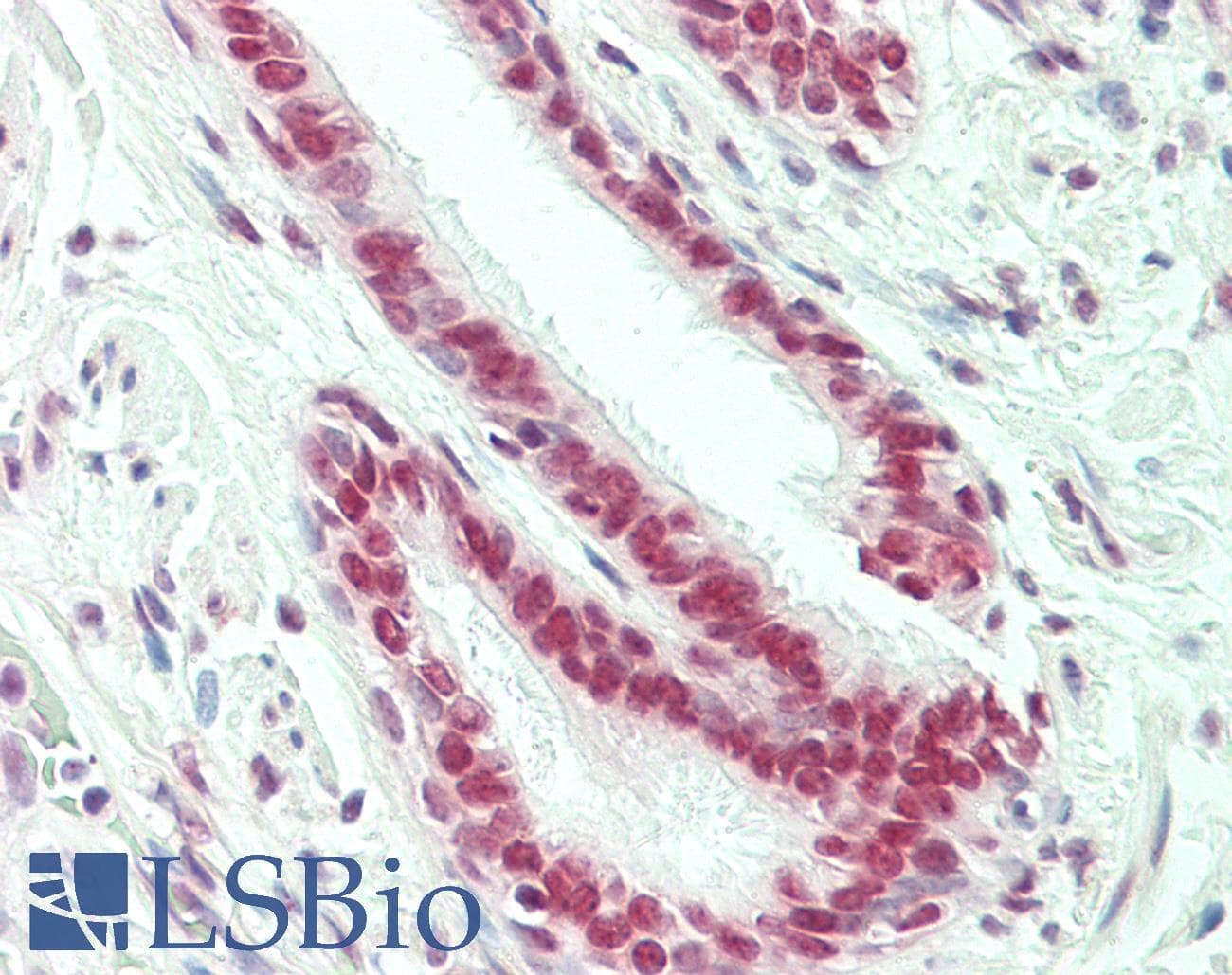 IHC-plus™ MATR3 / Matrin 3 Antibody (aa475-500)
