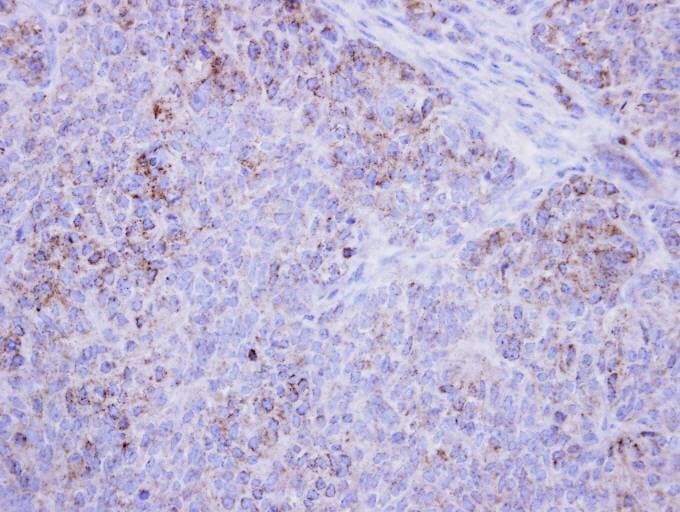 Polyclonal Rabbit anti-Human HSD17B4 Antibody (aa355-645, IHC, WB)