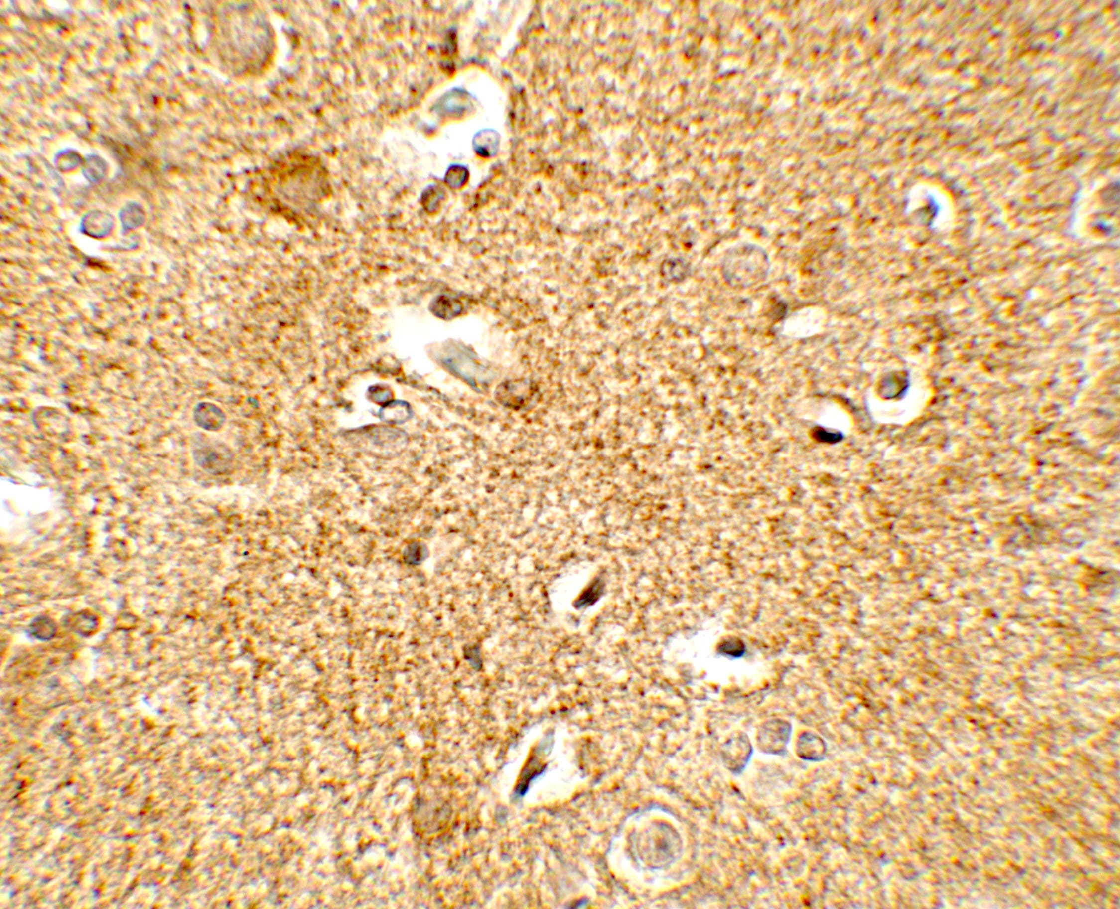 CRH / CRF Antibody