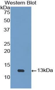 UTS2 / Urotensin II Antibody (aa20-120, Cy3)