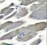 PIK3CG / PI3K Gamma Antibody (aa518-547)