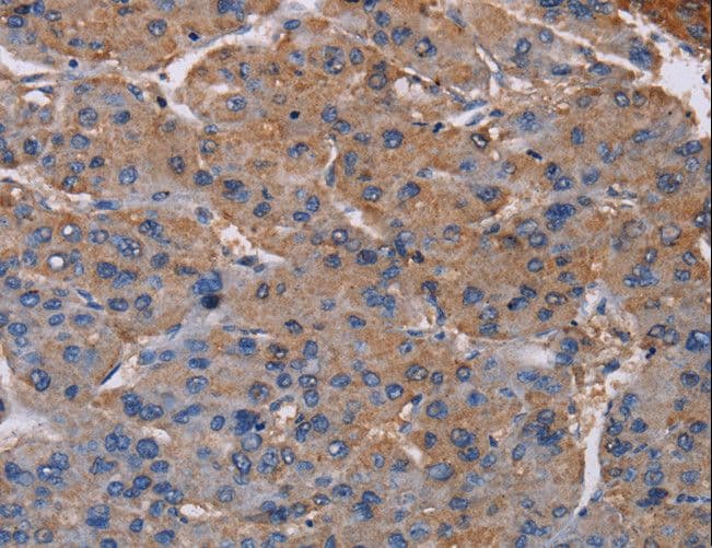 NDUFA9 Antibody