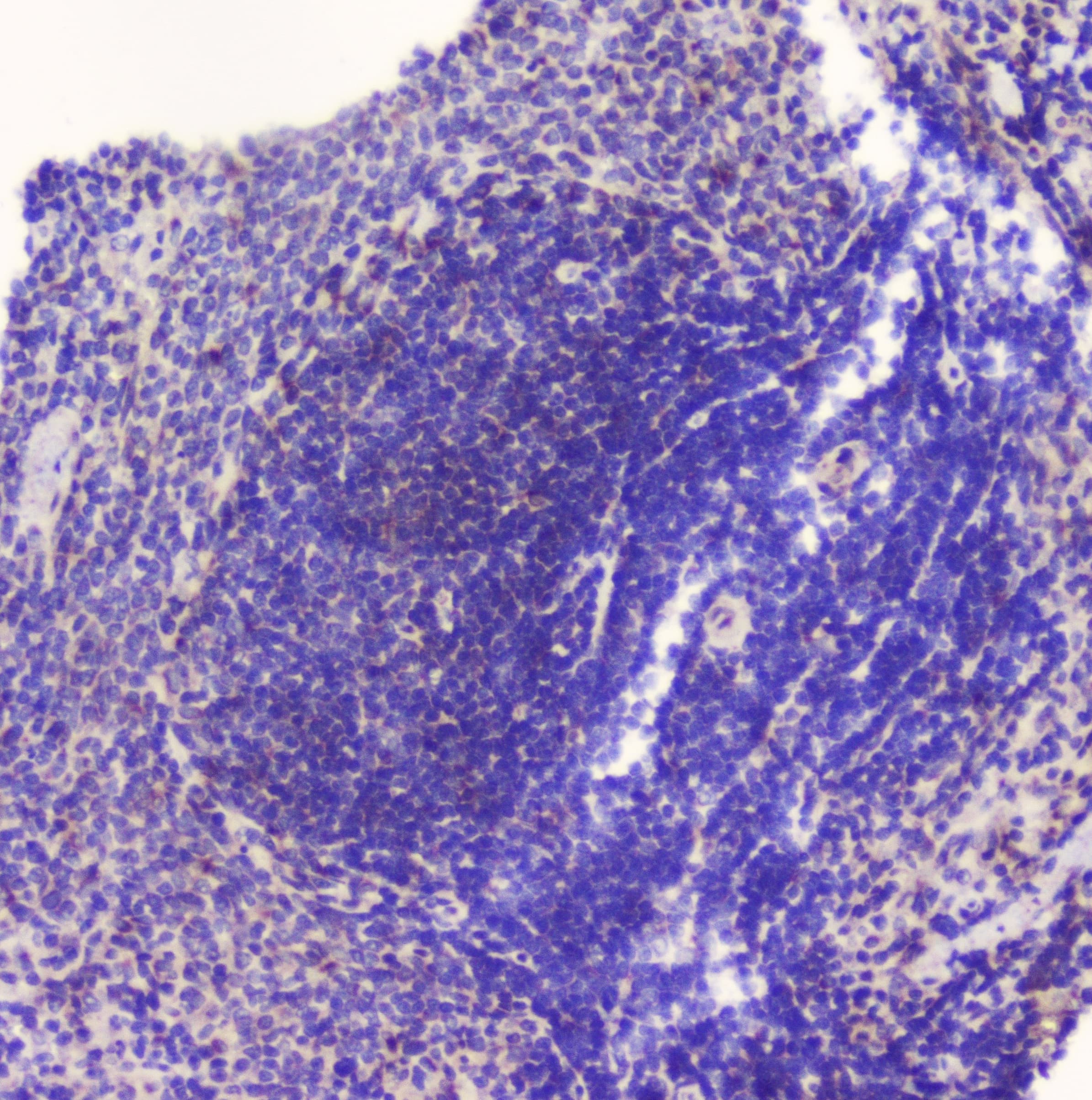 Polyclonal Rabbit anti-Human GOLGA2 / GM130 Antibody (IHC, WB)