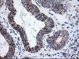 DLD / Diaphorase / E3 Antibody (clone OTI4D5)