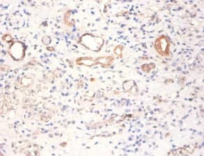 Polyclonal Rabbit anti-Human PKM / Pyruvate Kinase, Muscle Antibody (IHC)