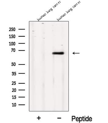MPP3 Antibody