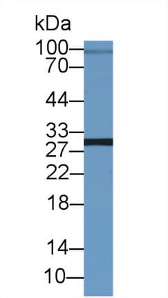 ASGR2 Antibody (aa1-311)