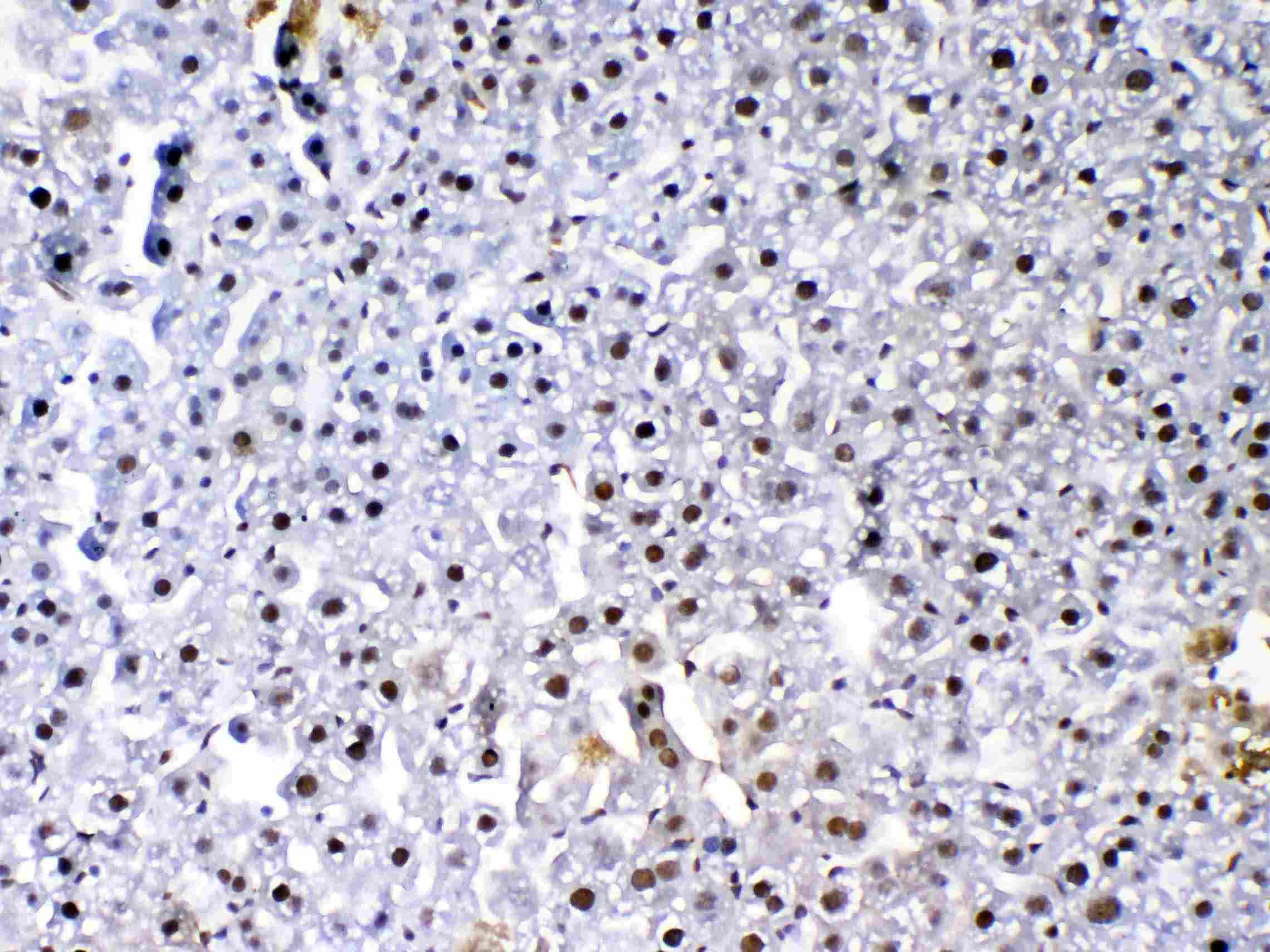 FLT4 / VEGFR3 Antibody