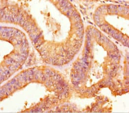 Polyclonal Rabbit anti-Human TPST2 Antibody (WB)