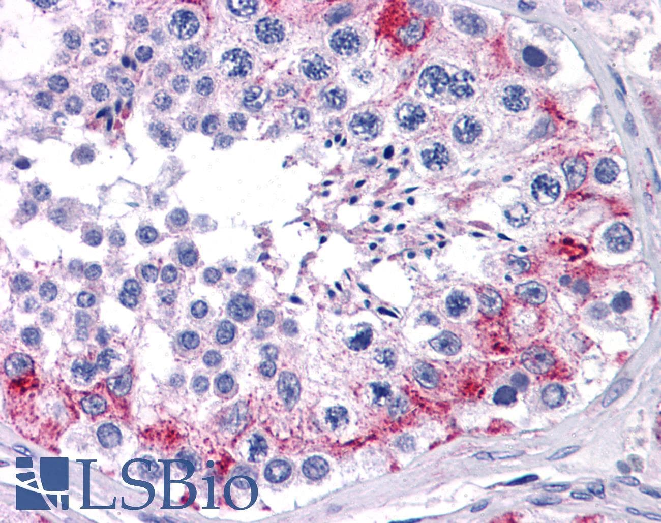 IHC-plus™ FAM175A / CCDC98 Antibody (clone ABRA1-01)