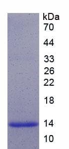 Human NEUROG3 / NGN3 / Neurogenin 3 Protein (Recombinant His)
