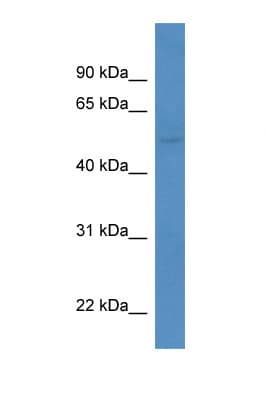 KCNK5 / TASK2 Antibody (aa236-285)