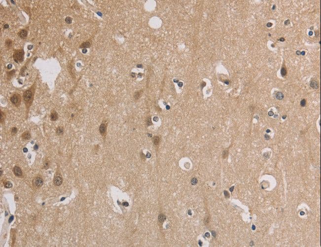 ELOVL1 Antibody