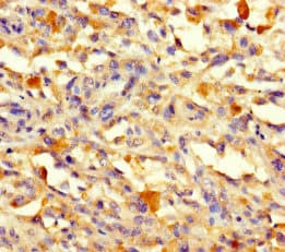 CCDC132 Antibody