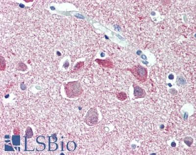 Polyclonal Rabbit anti-Human SYNPO / Synaptopodin Antibody (aa97-300, IHC, WB)