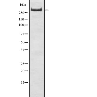 TG / Thyroglobulin Antibody