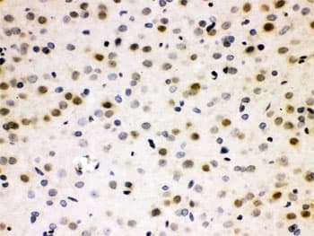 CDC25B Antibody