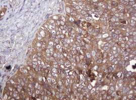 Monoclonal Mouse anti-Human ARPC5 / p16-Arc Antibody (clone 2G1, Carrier-free, IHC, WB)