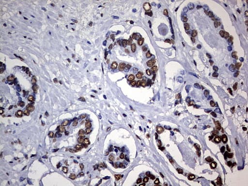 HNRPM / HNRNPM Antibody (aa1-261, clone OTI6H7)