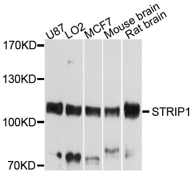 Polyclonal Rabbit anti-Human FAM40A Antibody (WB)