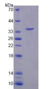 Human ARSF / Arylsulfatase F Protein (Recombinant His, N-Terminal)