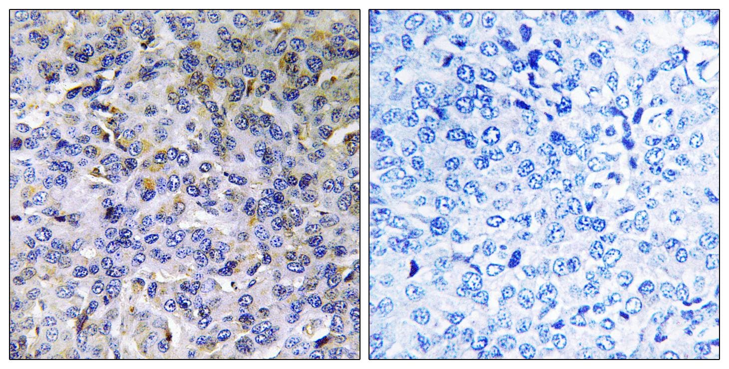 ACAD11 Antibody