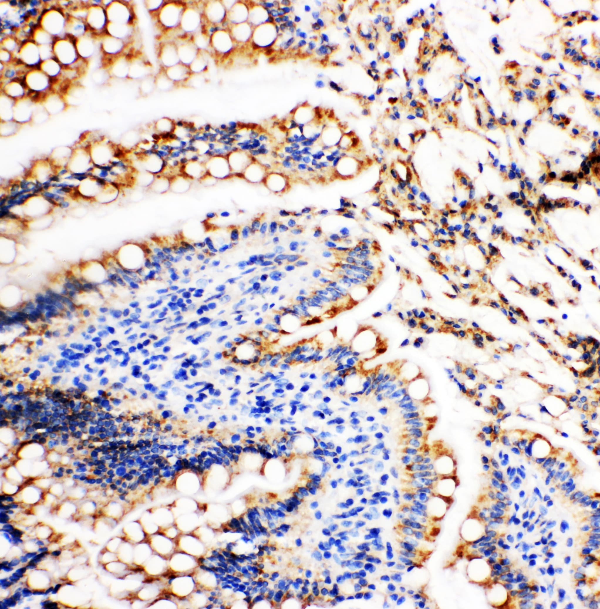 Polyclonal Rabbit anti-Human VCL / Vinculin Antibody (aa173-188, IHC, WB)
