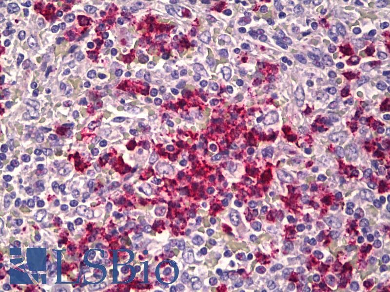 IHC-plus™ CDH23 / Cadherin 23 Antibody (aa61-110)