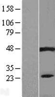 PIP5KL1 Protein (Over-Expression Lysate Myc-DDK (Flag))