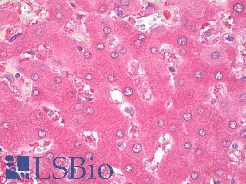 IHC-plus™ Thromboxane B2 11-Dehydrogenase Antibody