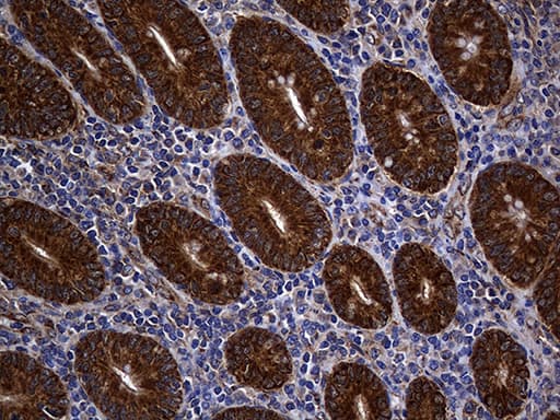 ALDH7A1 Antibody (clone OTI1A9, Carrier-free)