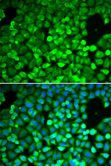 IPO5 / RANBP5 Antibody