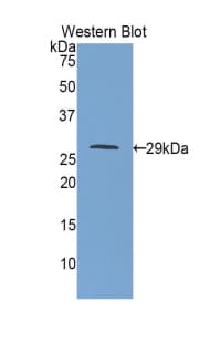 IGF2R / CD222 Antibody (aa1146-1363)