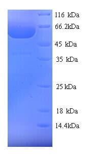 Chamaecyparis obtusa Polygalacturonase Protein (Recombinant His)