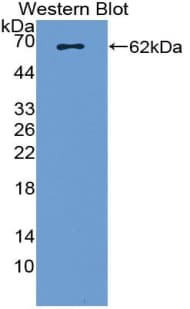 ADA / Adenosine Deaminase Antibody (aa11-280)