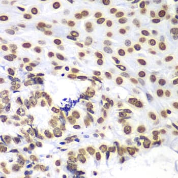 Polyclonal Rabbit anti-Human Histone H3 Antibody (IHC, IF, WB)