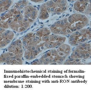 MST1R / RON Antibody (C-Terminus)