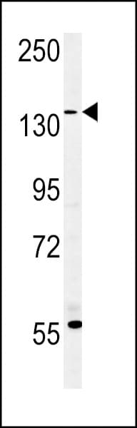 EMA / MUC1 Antibody (aa1202-1231)