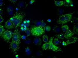 HSD17B10 / HADH2 Antibody (clone OTI5E2)