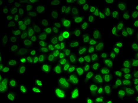 ASMT / HIOMT Antibody