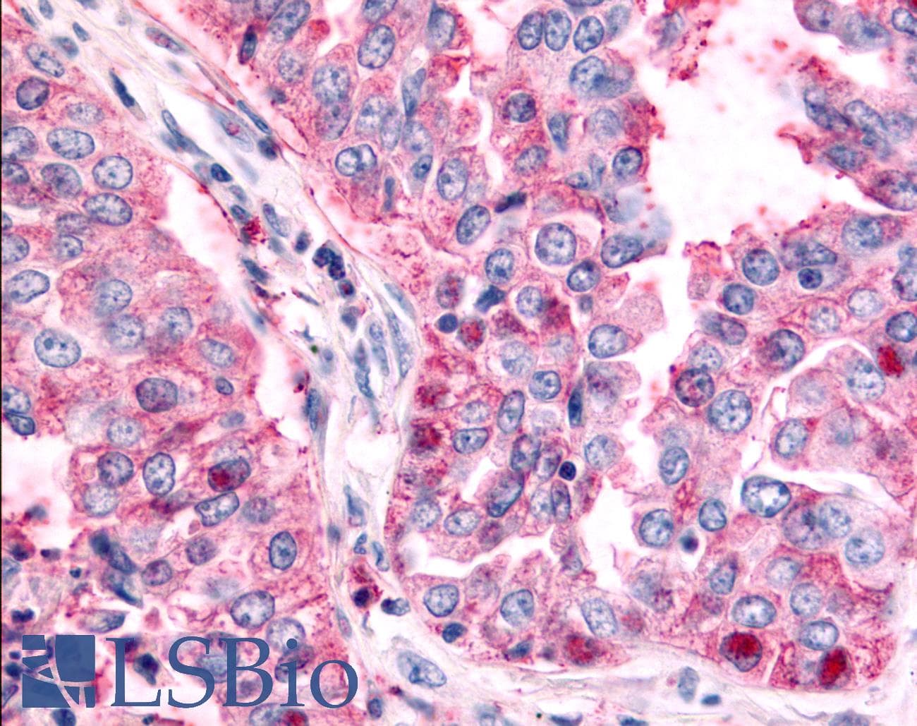 PathPlus™ TAOK1 / TAO1 Antibody (Internal)