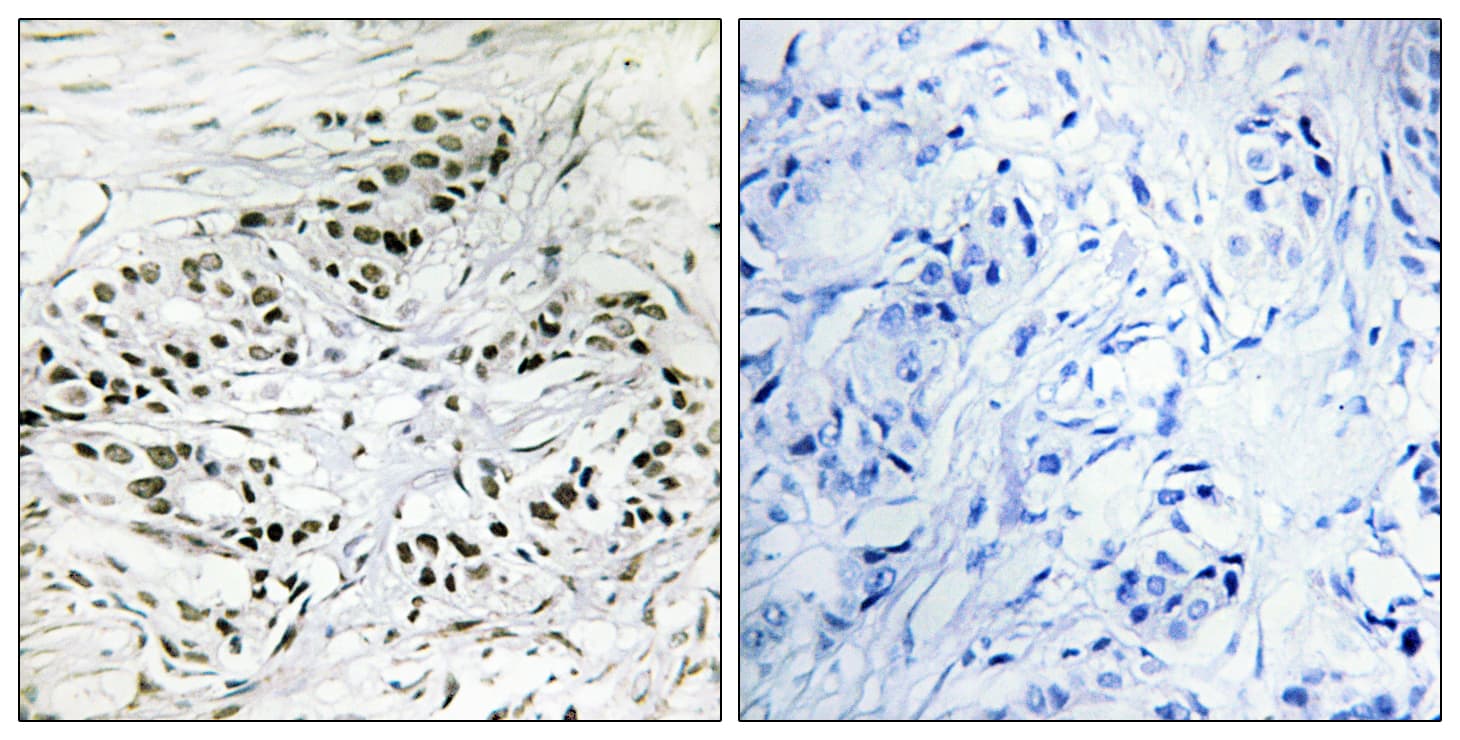ERF / PE2 Antibody (aa471-520)