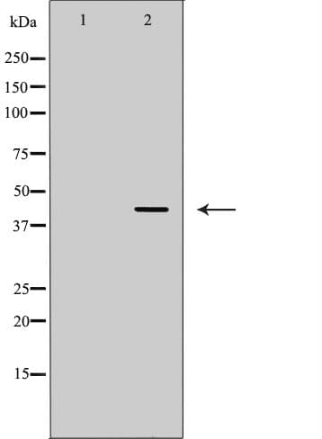 ADA / Adenosine Deaminase Antibody
