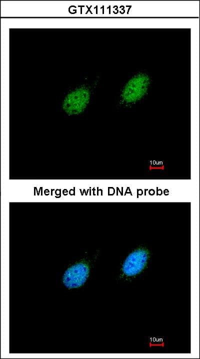 Polyclonal Rabbit anti-Human STK40 Antibody (aa156-372, WB)