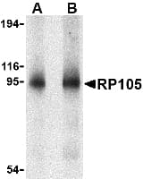 IHC-plus™ RP105 / CD180 Antibody